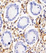 RHBDF2 Polyclonal Antibody