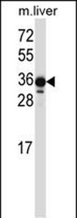 LIMS2 Polyclonal Antibody
