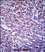 XIRP1 Polyclonal Antibody