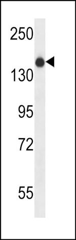 XIRP1 Antibody in Western Blot (WB)