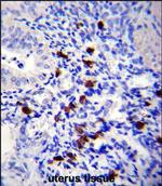 TNN Antibody in Immunohistochemistry (Paraffin) (IHC (P))