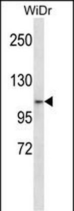ZNF836 Antibody in Western Blot (WB)