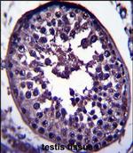 GAGE12H Polyclonal Antibody