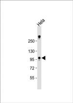 ZCCHC14 Polyclonal Antibody