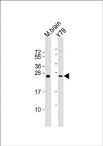 VKORC1L1 Polyclonal Antibody