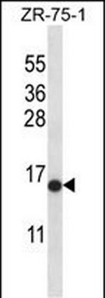 HIST2H2AB Antibody in Western Blot (WB)