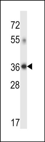 DHRS7C Antibody in Western Blot (WB)