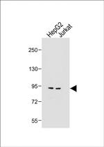 MGAT5 Polyclonal Antibody