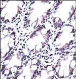 HRASLS5 Polyclonal Antibody