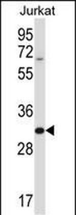HRASLS5 Antibody in Western Blot (WB)