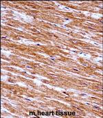 NEK6 Polyclonal Antibody