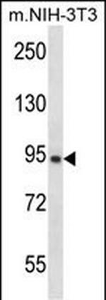 GRAMD1A Polyclonal Antibody