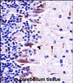 MLK4 Polyclonal Antibody
