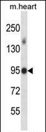 MLK4 Antibody in Western Blot (WB)