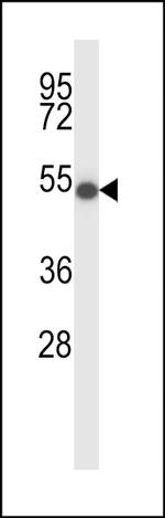ZDHHC16 Polyclonal Antibody