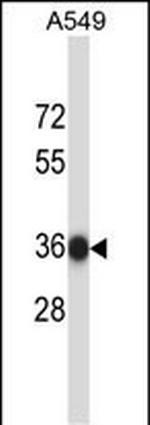 NAPB Polyclonal Antibody