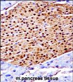 SCYL3 Polyclonal Antibody