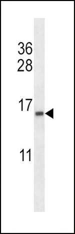 TCEB2 Polyclonal Antibody