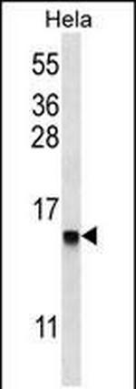 DEFB112 Polyclonal Antibody