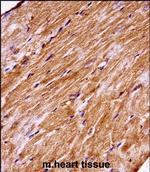 MAP4K3 Polyclonal Antibody