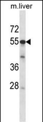 ADCK2 Polyclonal Antibody