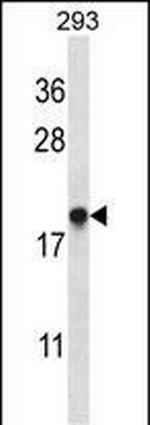 EMC4 Antibody in Western Blot (WB)