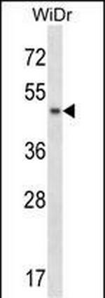 ANKS4B Polyclonal Antibody