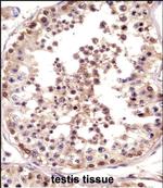 TSPY1 Polyclonal Antibody