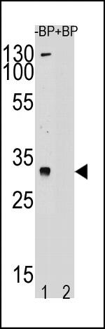 TSPY1 Antibody in Western Blot (WB)