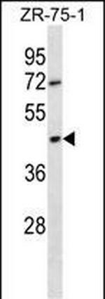 OR2T6 Polyclonal Antibody