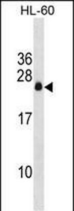 APRG1 Antibody in Western Blot (WB)