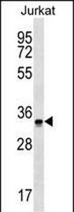 OR2G6 Polyclonal Antibody
