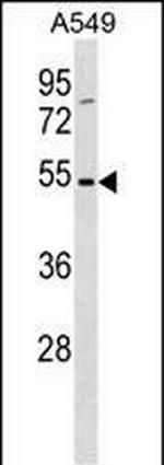 TM6SF1 Polyclonal Antibody