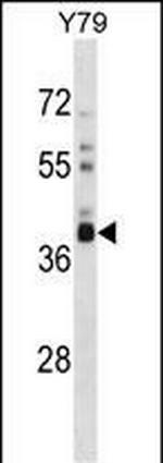 OR52L1 Polyclonal Antibody