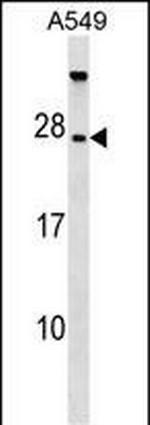 TBC1D28 Polyclonal Antibody