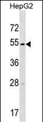 TMPRSS11E Polyclonal Antibody