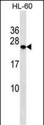 PCTP Polyclonal Antibody