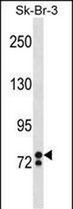ZNF263 Polyclonal Antibody