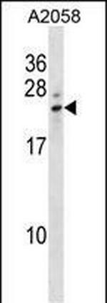 LCN8 Polyclonal Antibody