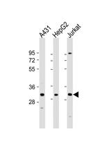 LY6G6F Polyclonal Antibody