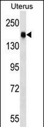 CGNL1 Polyclonal Antibody