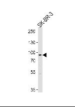 MTIF2 Polyclonal Antibody