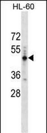 PRAMEF14 Polyclonal Antibody