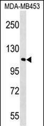 FAM65B Polyclonal Antibody