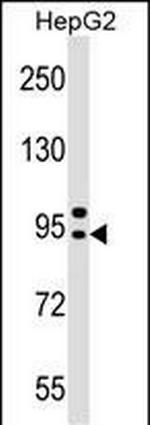 AP4B1 Polyclonal Antibody