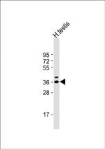 TSPY3 Polyclonal Antibody