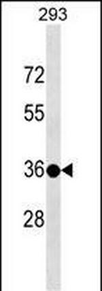 TSPY3 Antibody in Western Blot (WB)