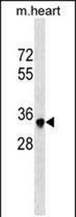 Sbk2 Antibody in Western Blot (WB)
