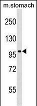 JIK Polyclonal Antibody
