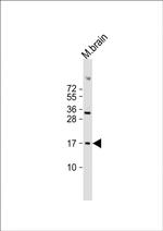FUNDC1 Antibody in Western Blot (WB)